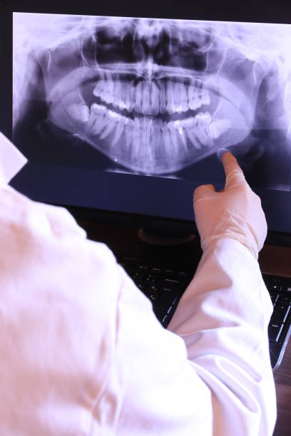 Best Mobile Emergency Dentist in Millington, NJ